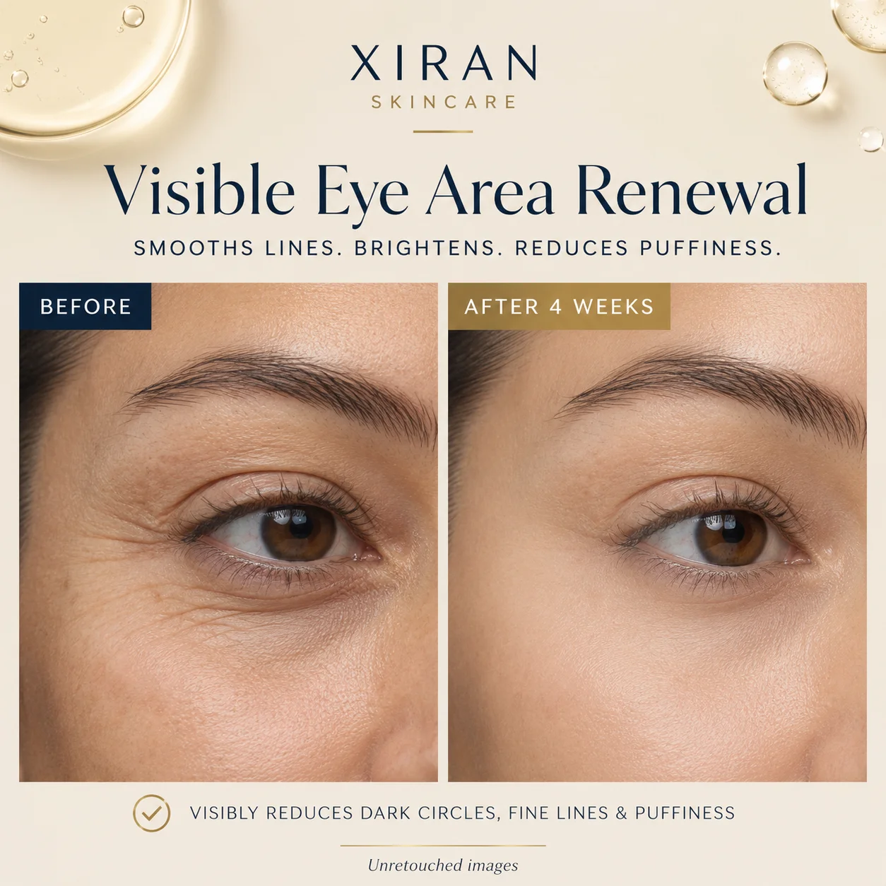 Comparison of eye area before and after using eye renewal product for four weeks, showing reduced puffiness, fine lines, and improved brightness.